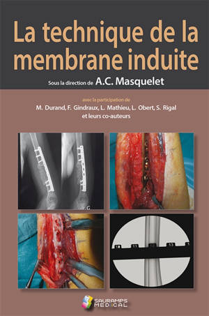 La technique de la membrane induite : principes, pratiques et perspectives