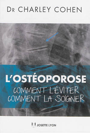 L'ostéoporose : comment l'éviter, comment la soigner
