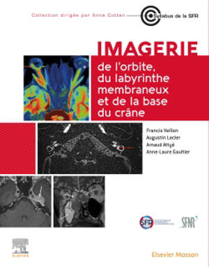 Imagerie de l'orbite, du labyrinthe membraneux et de la base du crâne