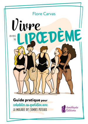 Vivre avec le lipoedème : guide pratique pour cohabiter au quotidien avec la maladie des jambes poteaux