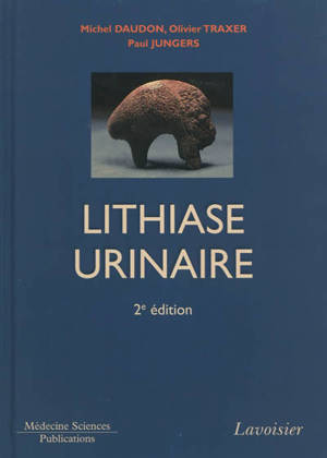 La lithiase urinaire