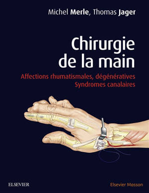 Chirurgie de la main. Affections rhumatismales, dégénératives, syndromes canalaires