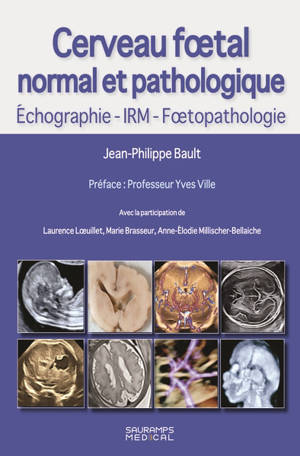 Cerveau foetal normal et pathologique : échographie, IRM, foetopathologie