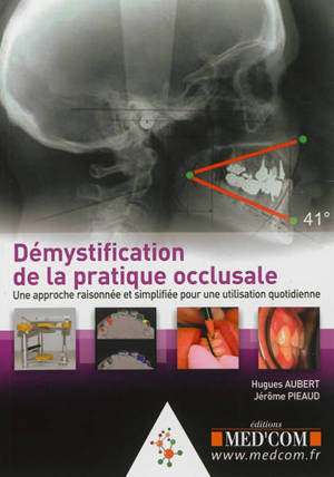 Démystification de la pratique occlusale
