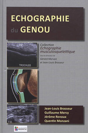 Echographie du genou