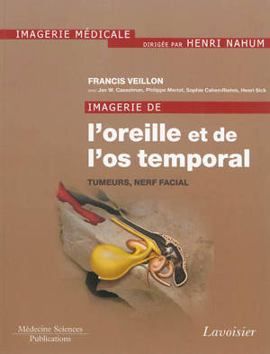 Imagerie de l'oreille et de l'os temporal. Vol. 4. Tumeurs, nerf facial