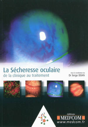 La sécheresse oculaire : de la clinique au traitement