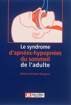 Le syndrome d'apnées-hypopnées obstructives du sommeil de l'adulte