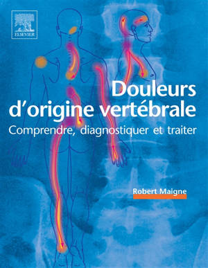 Douleurs d'origine vertébrale : comprendre, diagnostiquer et traiter