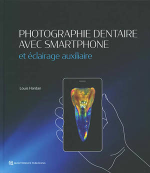 Photographie dentaire avec smartphone et éclairage auxiliaire