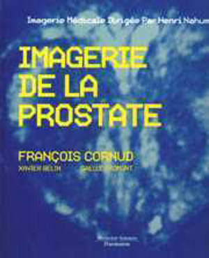L'Imagerie de la prostate