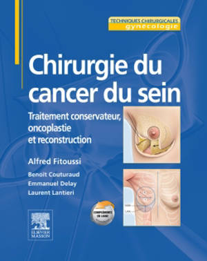 Chirurgie du cancer du sein : traitement conservateur, oncoplastie et reconstruction