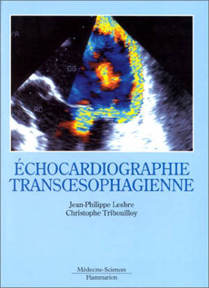 L'échocardiographie transoesophagienne