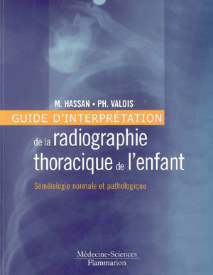 Guide d'interprétation de la radiographie thoracique de l'enfant : séméiologie normale et pathologique
