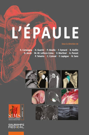 L'épaule