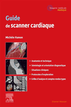 Guide de scanner cardiaque