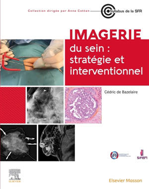 Imagerie du sein : stratégie et interventionnel