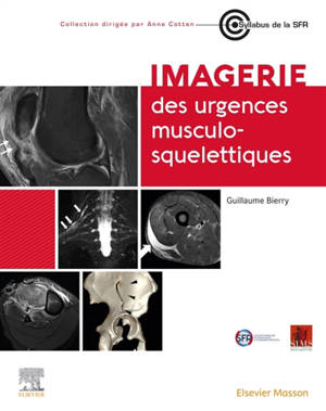 Imagerie des urgences musculosquelettiques