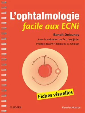 L'ophtalmologie facile aux ECNi : fiches visuelles