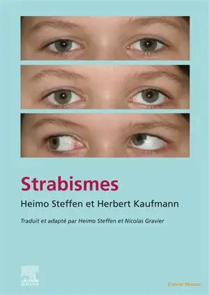 Strabismes