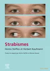 Strabismes