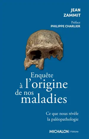 Enquête à l'origine de nos maladies : ce que nous révèle la paléopathologie