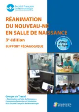 Réanimation du nouveau-né en salle de naissance : support pédagogique (octobre 2021)
