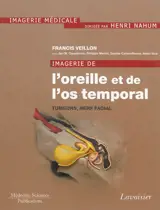 Imagerie de l'oreille et de l'os temporal. Vol. 4. Tumeurs, nerf facial