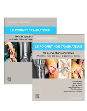 Pack Le poignet traumatique, le poignet non traumatique : 10 interventions courantes : tomes Manuel de chirurgie du membre supérieur