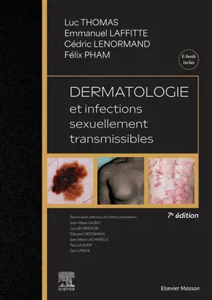 Dermatologie et maladies sexuellement transmissibles