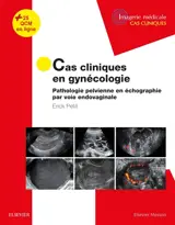 Cas cliniques en gynécologie : pathologie pelvienne en échographie par voie endovaginale