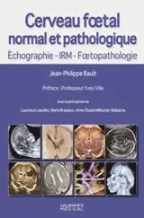 Cerveau foetal normal et pathologique : échographie, IRM, foetopathologie