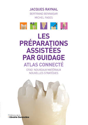Les préparations assistées par guidage