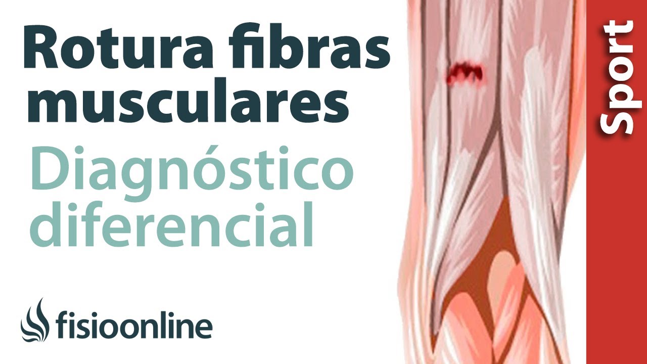 ¿Cómo saber si es una rotura de fibras?