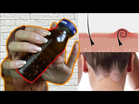 ¿Qué precio tiene el aceite de clavo?