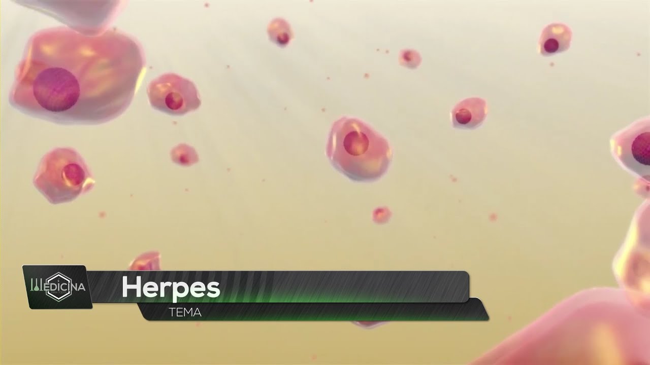 ¿Qué es bueno para curar el herpes en la piel?