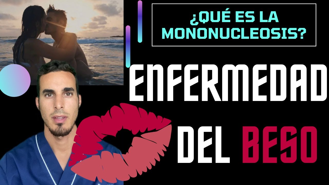 ¿Cómo sé si tuve mononucleosis?