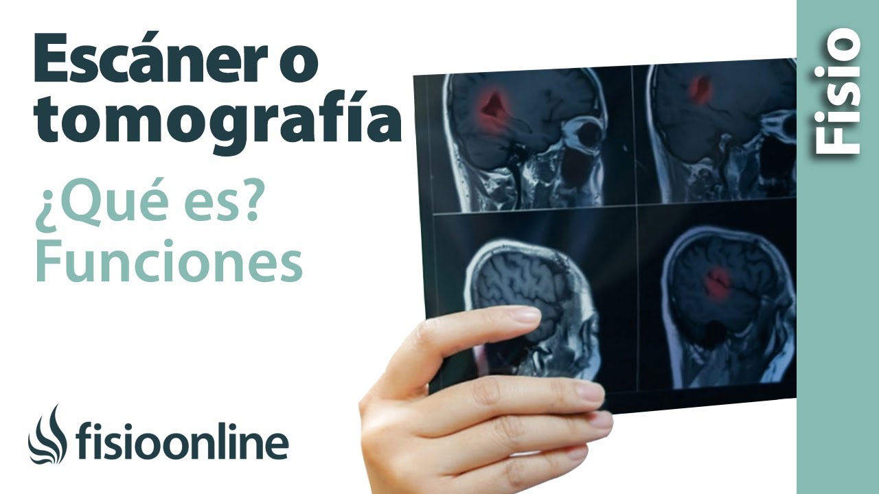 ¿Cuánto tiempo se tarda en hacer un escáner?