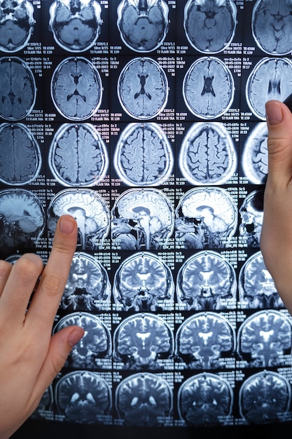 Roles del hemisferio derecho e izquierdo en el cerebro
