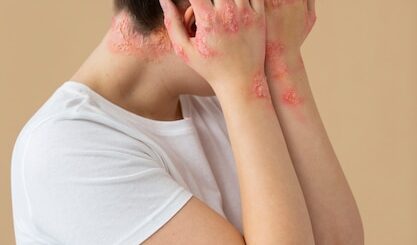 Las consecuencias del herpes sin tratamiento