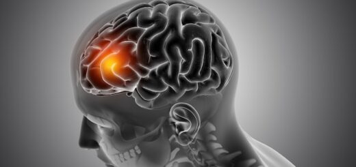Consecuencias del daño cerebral y sus impactos