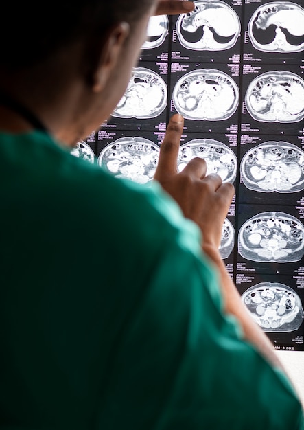 Consecuencias del daño cerebral y sus impactos 8 Consecuencias del daño cerebral y sus impactos