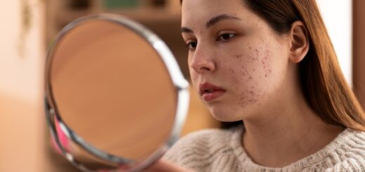 Descubriendo el significado de las imperfecciones perfectas