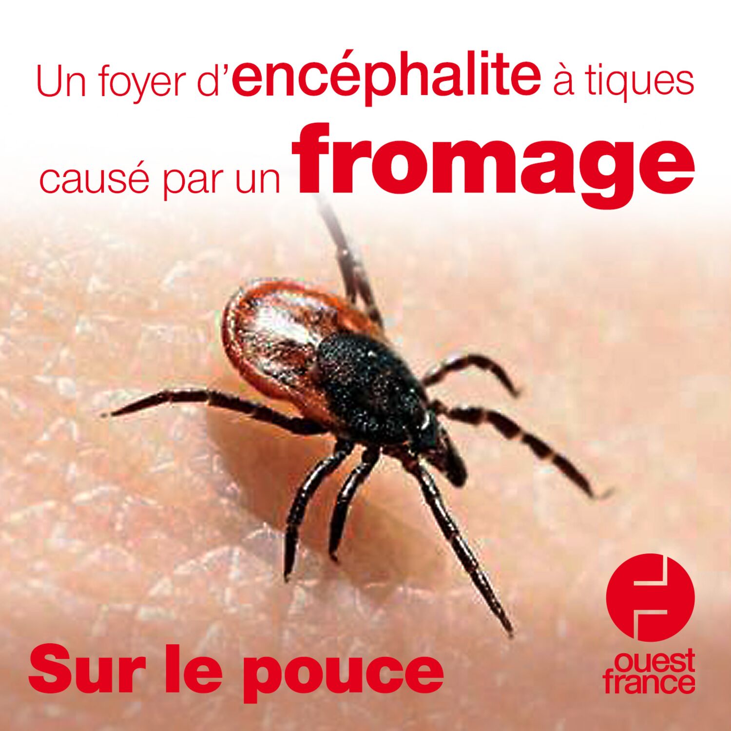 29 mai 2020 - Un foyer d’encéphalite à tiques causé par un fromage